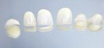 Veneers / Lumineers