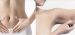 Body: Liposuction | Bauchdeckenstraffung | Oberarmstraffunf | Intimbereich