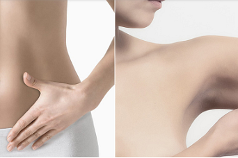 Body: Liposuction | Bauchdeckenstraffung | Oberarmstraffunf | Intimbereich