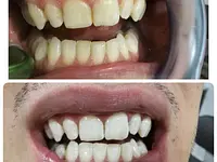 Dentalp SA - Klicken Sie, um das Bild 2 in einer Lightbox vergrössert darzustellen