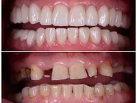 Clinique Dentaire de Meyrin – Cliquez pour agrandir l’image 15 dans une Lightbox