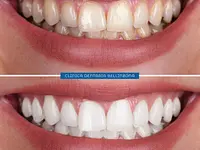 Clinica Dentaria Bellinzona Schulthess & Ottobrelli – Cliquez pour agrandir l’image 6 dans une Lightbox