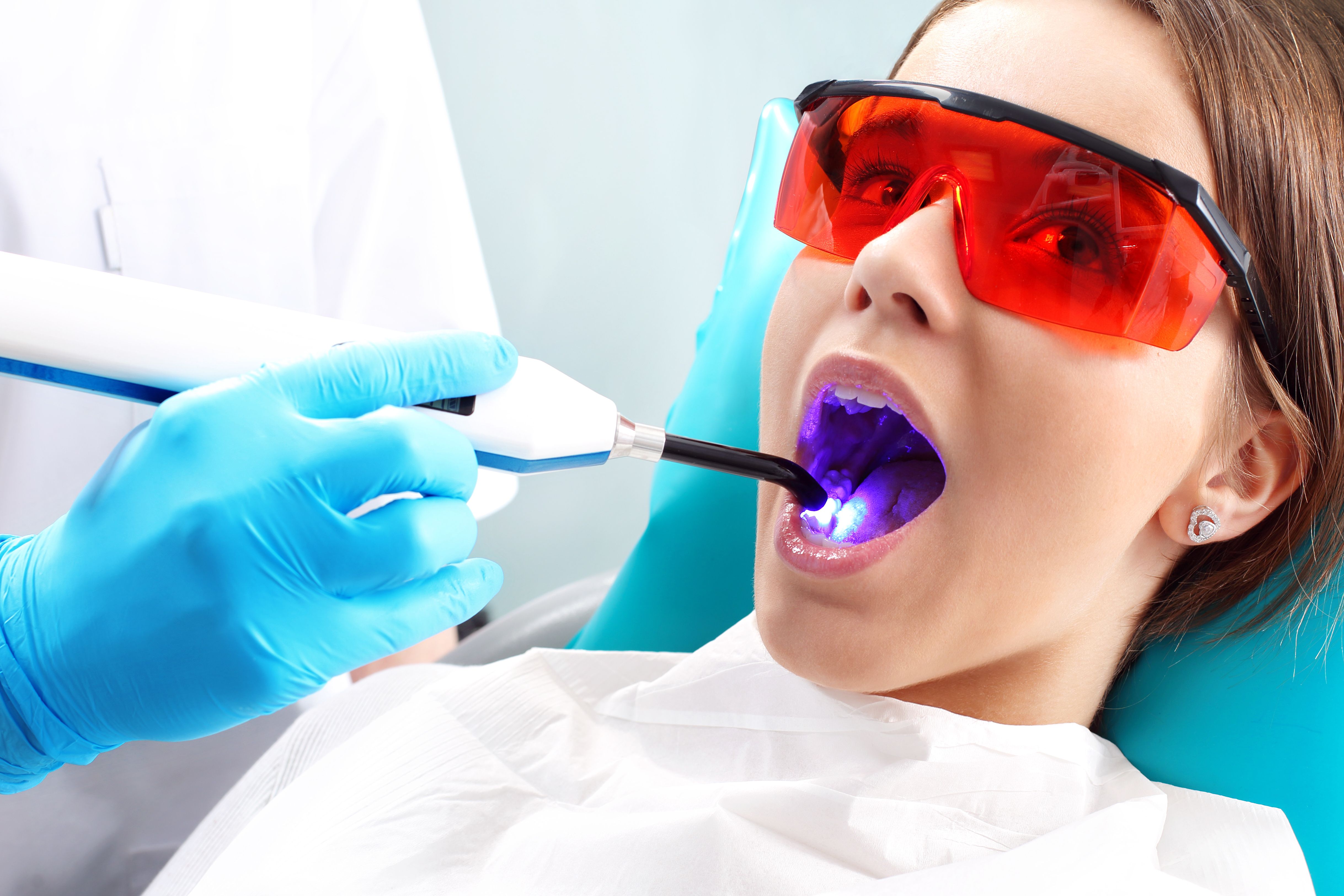 Obturation en composite dentaire | CORNAVIN Clinique dentaire