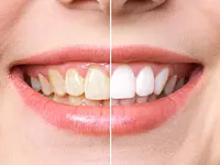 Clinique Dentaire de Meyrin - cliccare per ingrandire l’immagine 3 in una lightbox