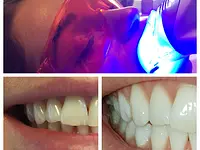 Dentalhygiene Tschan Claudia - cliccare per ingrandire l’immagine 7 in una lightbox