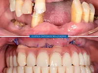Clinica Dentaria Bellinzona Schulthess & Ottobrelli – Cliquez pour agrandir l’image 5 dans une Lightbox