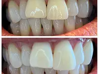 Dentalhygiene Tschan Claudia - Klicken Sie, um das Bild 11 in einer Lightbox vergrössert darzustellen