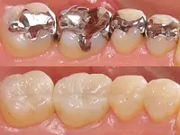 Clinique Dentaire de Meyrin - cliccare per ingrandire l’immagine 9 in una lightbox