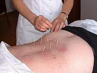 Acupuncture SinoSanté Sàrl – click to enlarge the image 2 in a lightbox