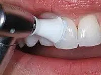 Zahnarztpraxis Organ - Klicken Sie, um das Bild 3 in einer Lightbox vergrössert darzustellen