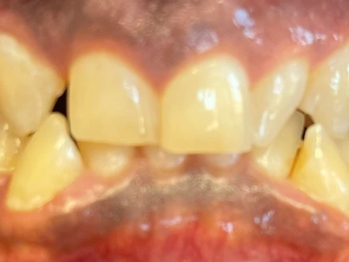 Cabinet dentaire Fabienne Roset – Cliquez pour agrandir l’image 5 dans une Lightbox