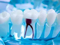 Centre Dentaire Champel – Cliquez pour agrandir l’image 3 dans une Lightbox