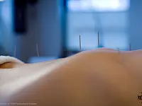 Akupunktur & TCM Heidi Gsteiger - cliccare per ingrandire l’immagine 12 in una lightbox