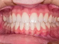 Zahnarztpraxis Coletti AG - Klicken Sie, um das Bild 10 in einer Lightbox vergrössert darzustellen