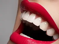 Naturlife Dental Mendrisio - Dr. Bontempelli Lorenzo - cliccare per ingrandire l’immagine 7 in una lightbox