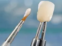 Dentaltechnik G. Stutzer - Klicken Sie, um das Bild 2 in einer Lightbox vergrössert darzustellen