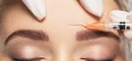 Botox Behandlungen