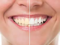 Centre Dentaire Chêne-Bourg – Cliquez pour agrandir l’image 9 dans une Lightbox