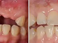 Zahnarztpraxis - Dr. med. dent. Theres Wyss AG - Klicken Sie, um das Bild 7 in einer Lightbox vergrössert darzustellen