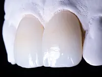 Zahnarztpraxis Schwanengasse - Klicken Sie, um das Bild 4 in einer Lightbox vergrössert darzustellen