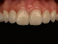 Vinci Dental Concept SA – Cliquez pour agrandir l’image 4 dans une Lightbox