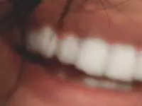 Dentalhygiene Seefeld – Cliquez pour agrandir l’image 5 dans une Lightbox