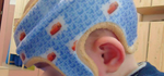 Casques crâniens