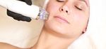 Microneedling
