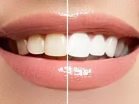 Zahnarztpraxis Dr.med.dent. Andres Pastori AG - Klicken Sie, um das Bild 8 in einer Lightbox vergrössert darzustellen