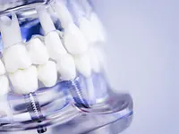 Il Dentista Dr. Alessandro Rossi SA - cliccare per ingrandire l’immagine 9 in una lightbox