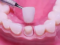 K-Dent médecine dentaire Zahnmedizin – Cliquez pour agrandir l’image 4 dans une Lightbox