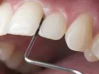 K-Dent médecine dentaire Zahnmedizin – Cliquez pour agrandir l’image 9 dans une Lightbox