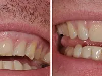 Zahnarztpraxis - Dr. med. dent. Theres Wyss AG - Klicken Sie, um das Bild 5 in einer Lightbox vergrössert darzustellen