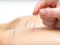Acupuncture Sino Bien-être Cabinet de la Médecine Traditionnelle Chinoise – Cliquez pour agrandir l’image 1 dans une Lightbox