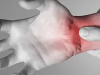 OsteoRheuma Bern AG - Klicken Sie, um das Bild 2 in einer Lightbox vergrössert darzustellen