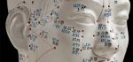 Acupuncture
