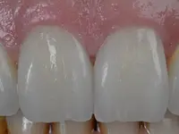 Vinci Dental Concept SA – Cliquez pour agrandir l’image 1 dans une Lightbox