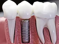 K-Dent médecine dentaire Zahnmedizin – Cliquez pour agrandir l’image 6 dans une Lightbox