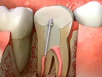 K-Dent médecine dentaire Zahnmedizin