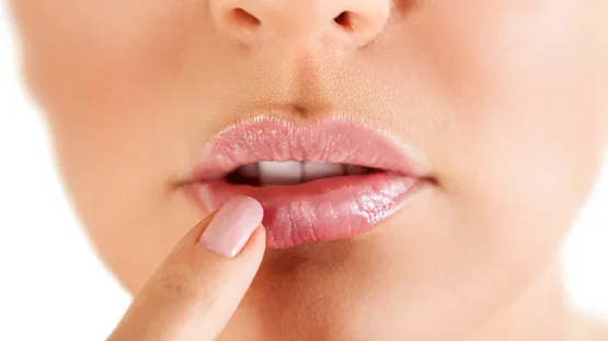 Lippenherpes konsequent behandeln
