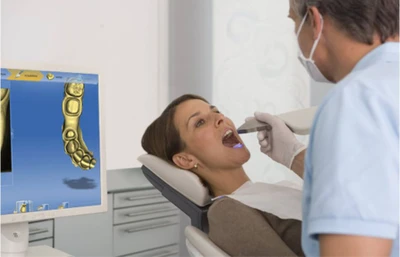 Empreinte digitale CEREC