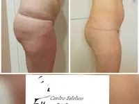 Centro Estetico Oltre L'Immagine di Lidia Schiavo