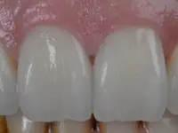 Vinci Dental Concept SA - Klicken Sie, um das Bild 1 in einer Lightbox vergrössert darzustellen