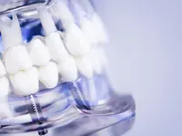 Il Dentista Dr. Alessandro Rossi SA