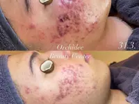 Orchidee Beauty Center