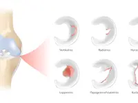 Physiotherapie Heiniger und Psychologische Körperarbeit - Klicken Sie, um das Bild 13 in einer Lightbox vergrössert darzustellen