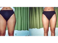 Medical Aesthetic Urs Benz