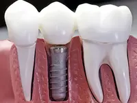 K-Dent médecine dentaire Zahnmedizin