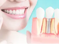 MySmile Cabinet dentaire Vésenaz