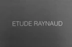 Etude Raynaud